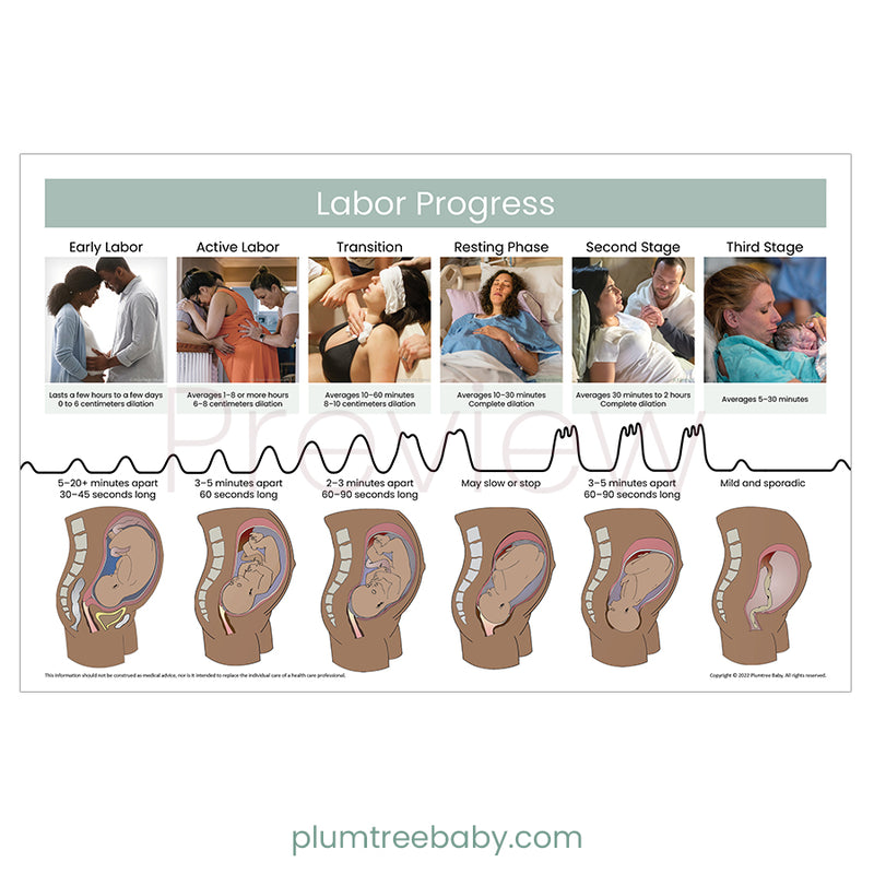 Labor Progress Poster-Poster-Plumtree Baby