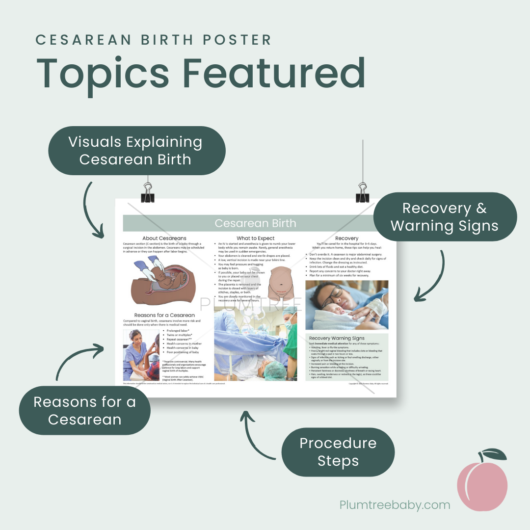 Cesarean Birth Poster-Poster-Plumtree Baby