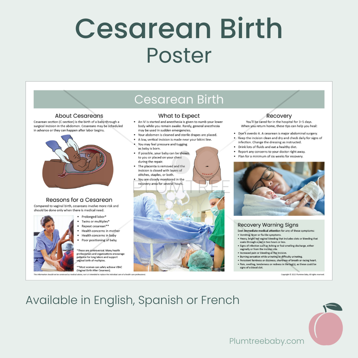 Cesarean Birth Poster-Poster-Plumtree Baby
