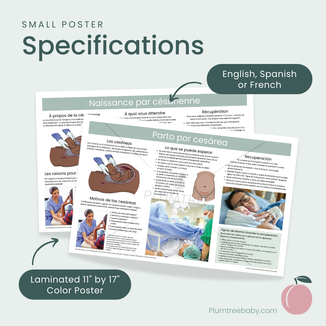 Cesarean Birth Poster-Poster-Plumtree Baby