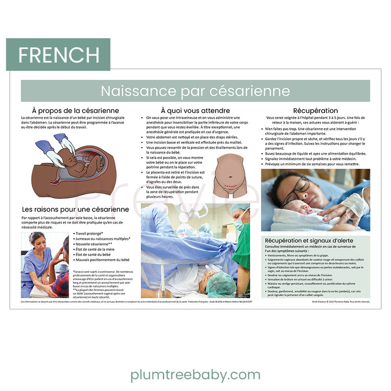 Cesarean Birth Poster-Poster-Plumtree Baby