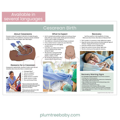 Cesarean Birth Poster-Poster-Plumtree Baby