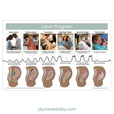 Labor Progress Poster-Poster-Plumtree Baby