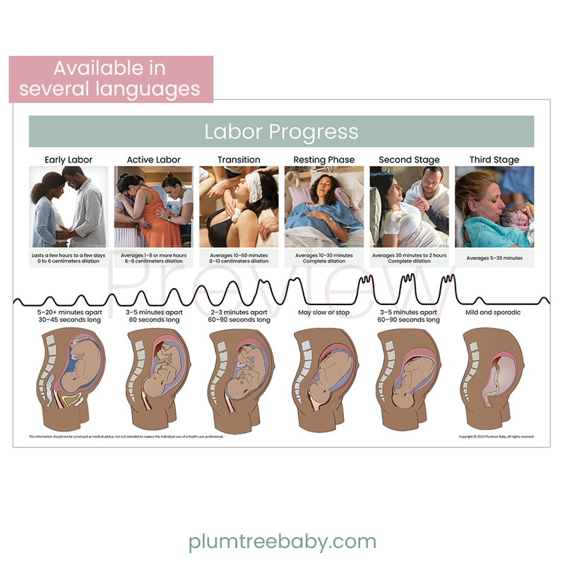 Labor Progress Poster-Poster-Plumtree Baby